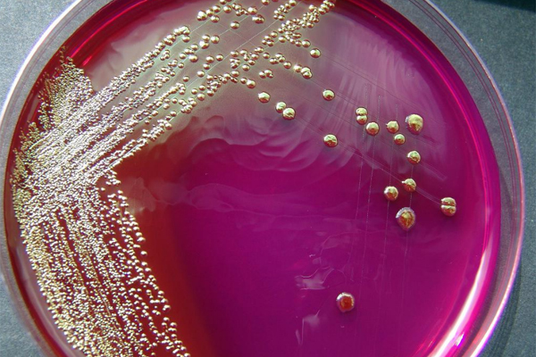Bakterii_E-coli
